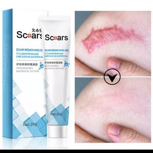 Herbal Scar Removal Burn Surgical Cesarean Stretch Marks Removal cream